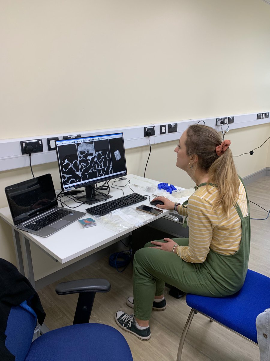 TobacHistory's tweet photo. Fantastic day with @hlcross6 at Keele yesterday looking at BMD of our femur samples from Barton on their #microCT hoping to see if we can find a link with past smoking #archaeologicalsci https://t.co/td6XeUNbx6