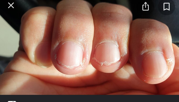 Em_m_ie's tweet photo. Aqa babes, you owe me a mani <33 #aqa #gcses2022 https://t.co/FWaV4uyyyT