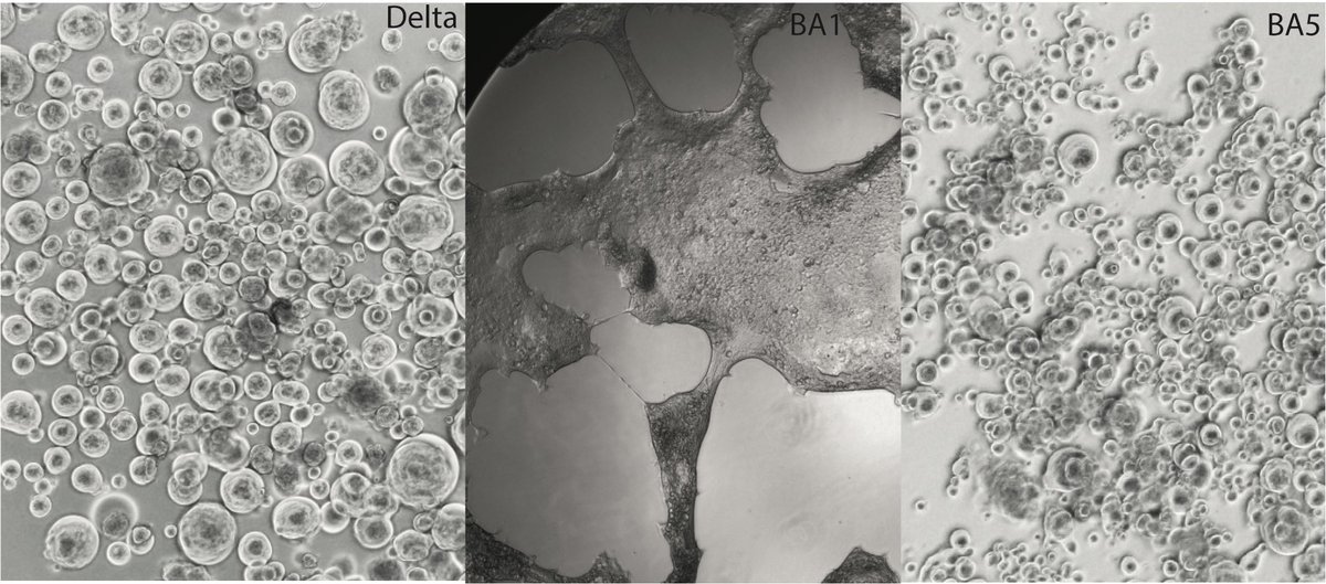 StuartTurville's tweet photo. @Mike_Honey_ @EricTopol BA5 has switched tropism again to use TMPRSS2. It’s like a viral yo-yo. Here’s what Delta, BA1 and BA5 look like in cells with TMPRSS2 when exposed to positives samples and left for three days. https://t.co/Hr3Hcu7FUC