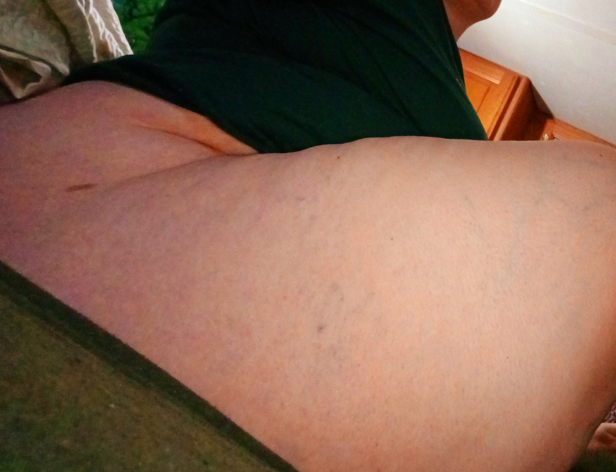 beau_echo_'s tweet photo. When I said #thiccaf I meant it.
#onlyfans #sellingcontent #ftm #onlyfansftm #bigqueerbody
https://t.co/2wrMTXRBDM https://t.co/yD44yePZik
