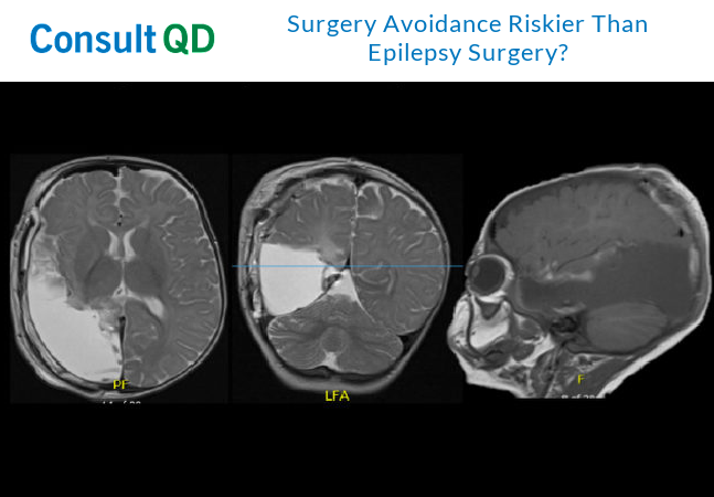 Cleveland Clinic Florida (@cleveclinicfl) on Twitter photo #Brainsurgery is no longer a last resort for those with #epilepsy. Data shows that about 60% of patients achieve long-term #seizure freedom following #epilepsysurgery.
<a href="/Camiloggr/">Camilo Garcia MD</a>, a board-certified epileptologist explains more:
cle.clinic/3H99SBX #EpilepsyAwareness #Brainsurgery is no longer a last resort for those with #epilepsy. Data shows that about 60% of patients achieve long-term #seizure freedom following #epilepsysurgery.
<a href="/Camiloggr/">Camilo Garcia MD</a>, a board-certified epileptologist explains more:
cle.clinic/3H99SBX #EpilepsyAwareness