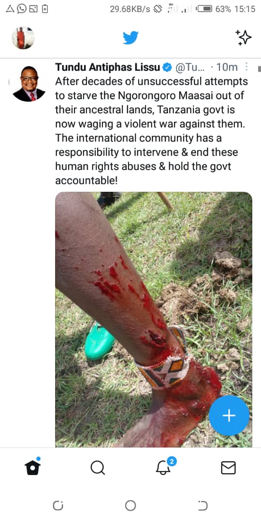 What is happening in Ngorongoro is heartbreaking,  we call upon international community to intervene.  Children, women, men and  elderly people are suffering in their land.