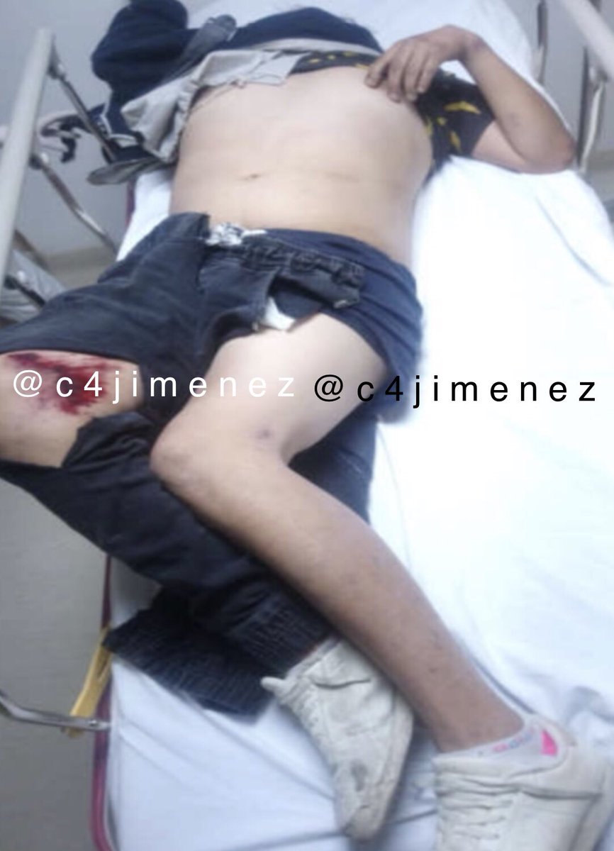 c4jimenez's tweet photo. EL SUFRIMIENTO de UNA RATA
Es Alejandro Arias
Asaltó y golpeó a una mujer y a sus hijas de 17 y 9 años.
Vecinos de @Alc_Iztapalapa las defendieron y lo apalearon.
Acabó así: golpeado, con una pierna rota, en el hospital y llorando con @SSC_CDMX.
Si ud lo reconoce, denúncielo! https://t.co/mmcwCipXi0