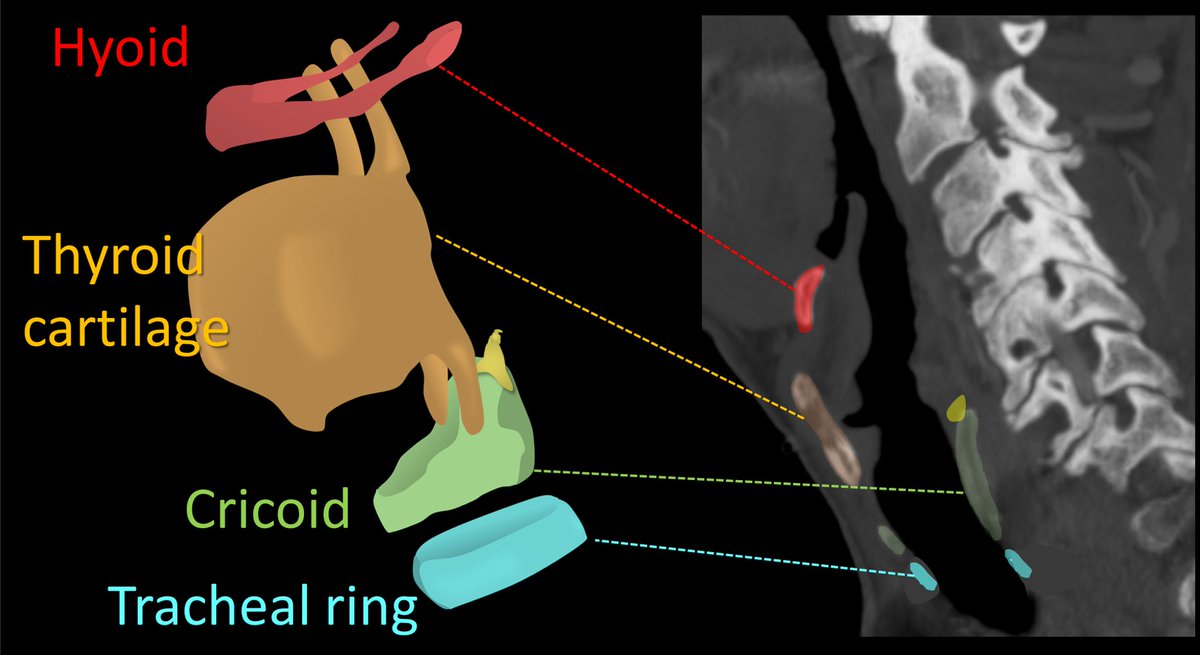 11/So here's the summary of laryngeal supporting structures & how they relate to other structures. Hopefully this has shined some light on the black box of voice box anatomy!Laryngeal anatomy is too complex for one tweetorial--this is just the beginning--stay tuned for more 