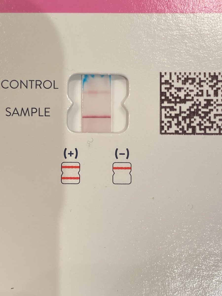 TraumaDocSF's tweet photo. I have some news. I have tested positive for COVID19 after an exposure I had. I am self isolating and taking paxlovid and hoping for a speedy recovery. Glad that I am fully vaccinated and boosted twice. The new omicron variant is really infectious. https://t.co/q6lLcGQe2s