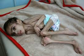 ChiefSharp's tweet photo. As like every Friday at 18:00 GMT please join twitter storm for Yemen to make heard innocent children voices.
#YemenCantWait
#StandUpForYemen
#StopAllWars https://t.co/qDzaIMxAVq