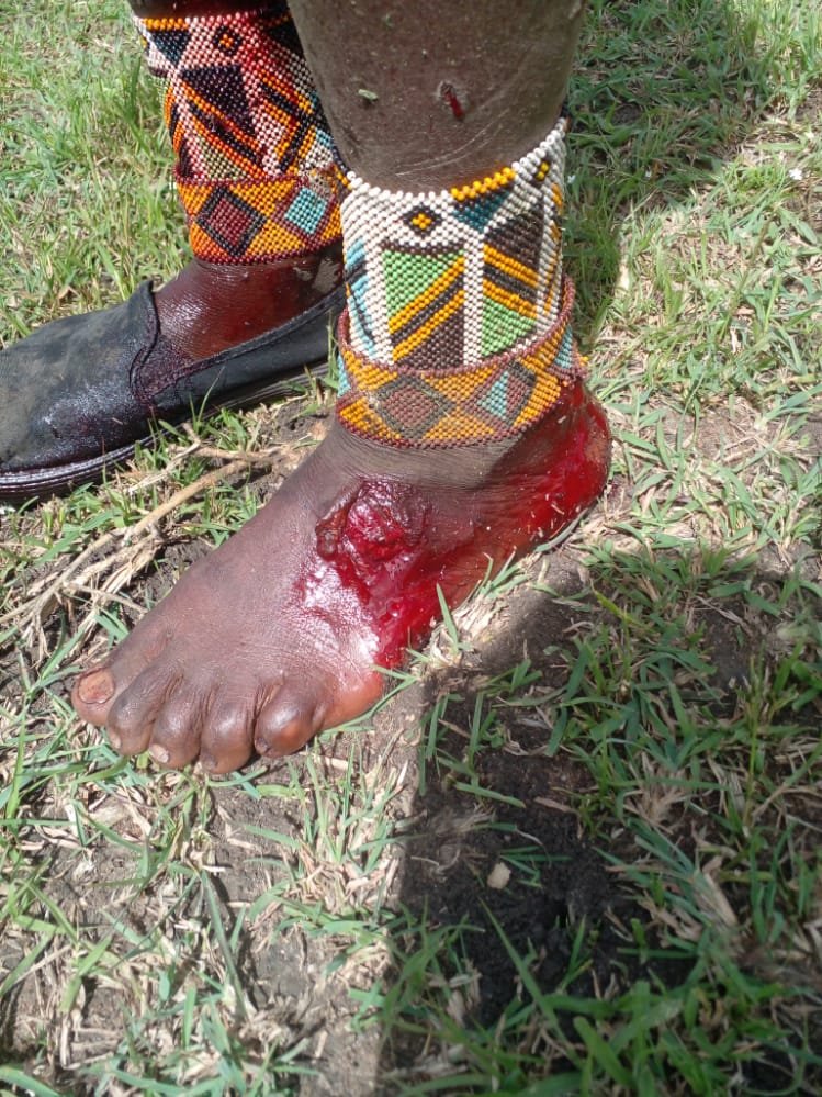 chriswel6's tweet photo. This was a proud, innocent,patriotic and a dyed-in-the-wool lover of Tanzania, wearing a beaded flag on her shin.Enduaring a heart piercing pain meted on her by her beloved government for no reason!Dark moment for the Maasai of Tanzania 😭😭
@SuluhuSamia https://t.co/g44JTvcqtT