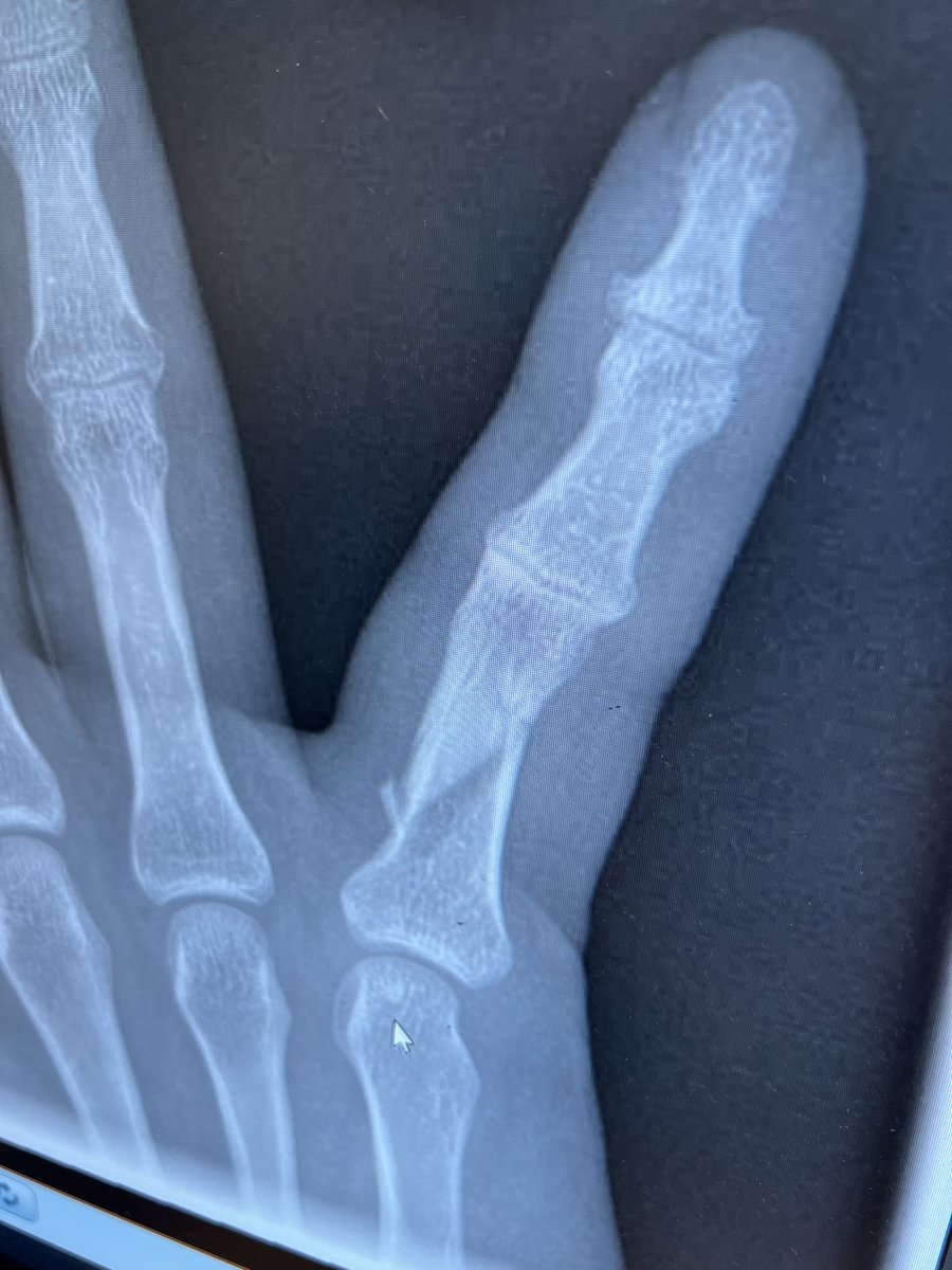 Well that hurt a little 😅