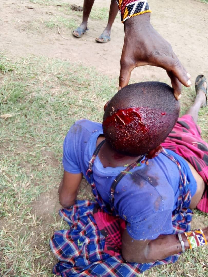 Chama cha wananchi cuf tunalaani vikali vitendo vya kijana walivyo fanyiwa MASAI katika maeneo ya Ngorongoro. Busara ndo msingi mkuu wa amani, nguvu, vitisho kamwe haviwezi kutatua migogoro. Kuna haja ya Serikali kujithmini juu ya jambo hili na dhulma na nyanyasi wa raia.