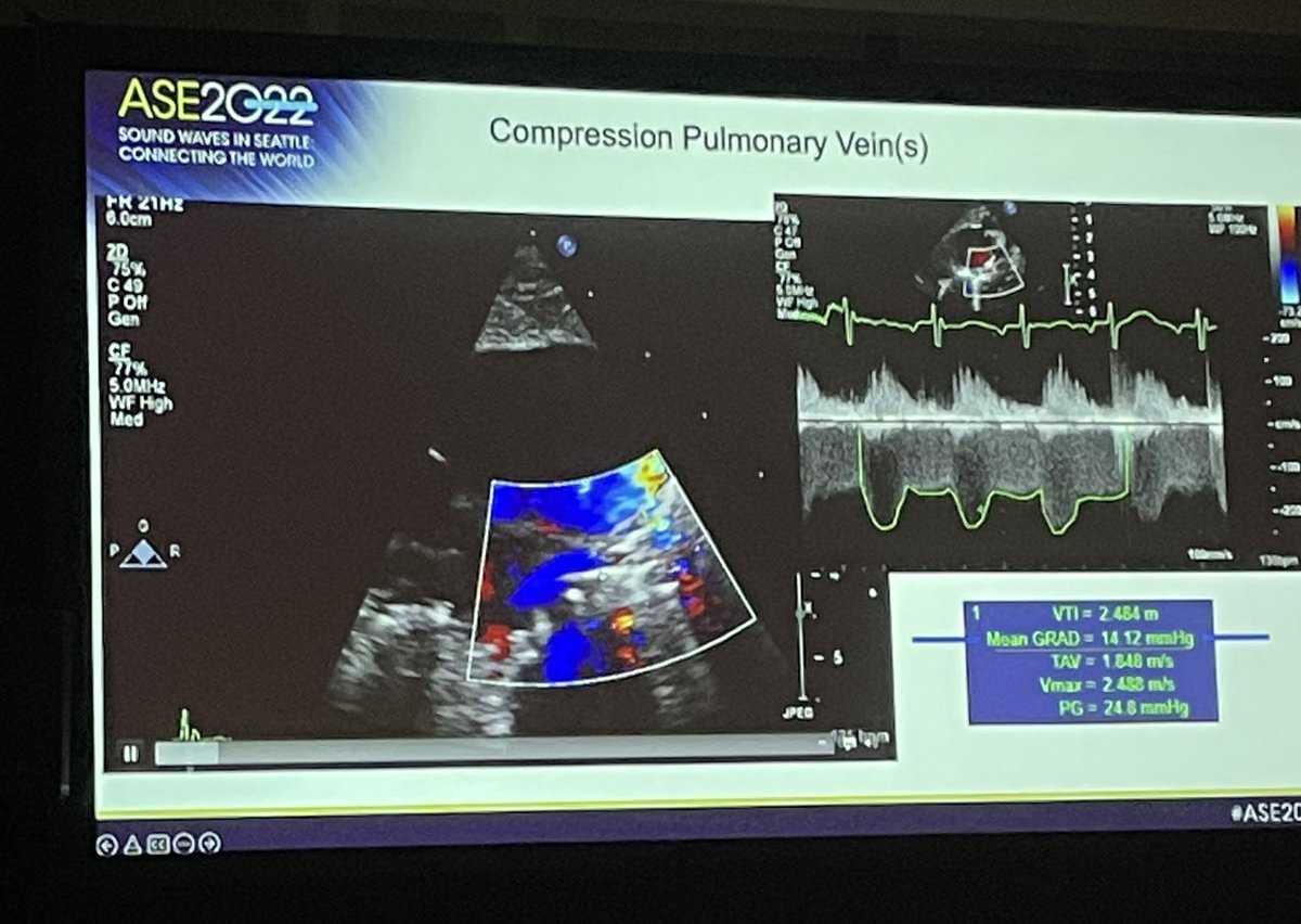 nehasonipatel's tweet photo. Attending the echo path session. The pathology pictures are insane! Great presentations @ASE360 #2years2long #IAmEchoNerd #ASE2022 #SeeYouInSeattle #NoMoreQuarantine #echofirst #CardiaKids #sonographerNOTtech #WomenInEcho https://t.co/LvfGNHylrc