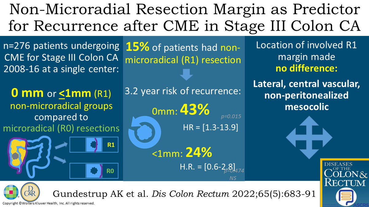 DCRjournal's tweet photo. Another #DCRJournal visual abstract to discuss - Margin Status &amp; Recurrence Rates After Complete Mesocolic Excision for Stage III #ColonCancer https://t.co/gLUthD5nz3

@KyleCologne @JohnRTMonsonMD @jendavidsmd @ScottRSteeleMD @Swexner @me4_so @ACPGBI @drtracyhull @ASCRS_1 https://t.co/3oBSEzewyI