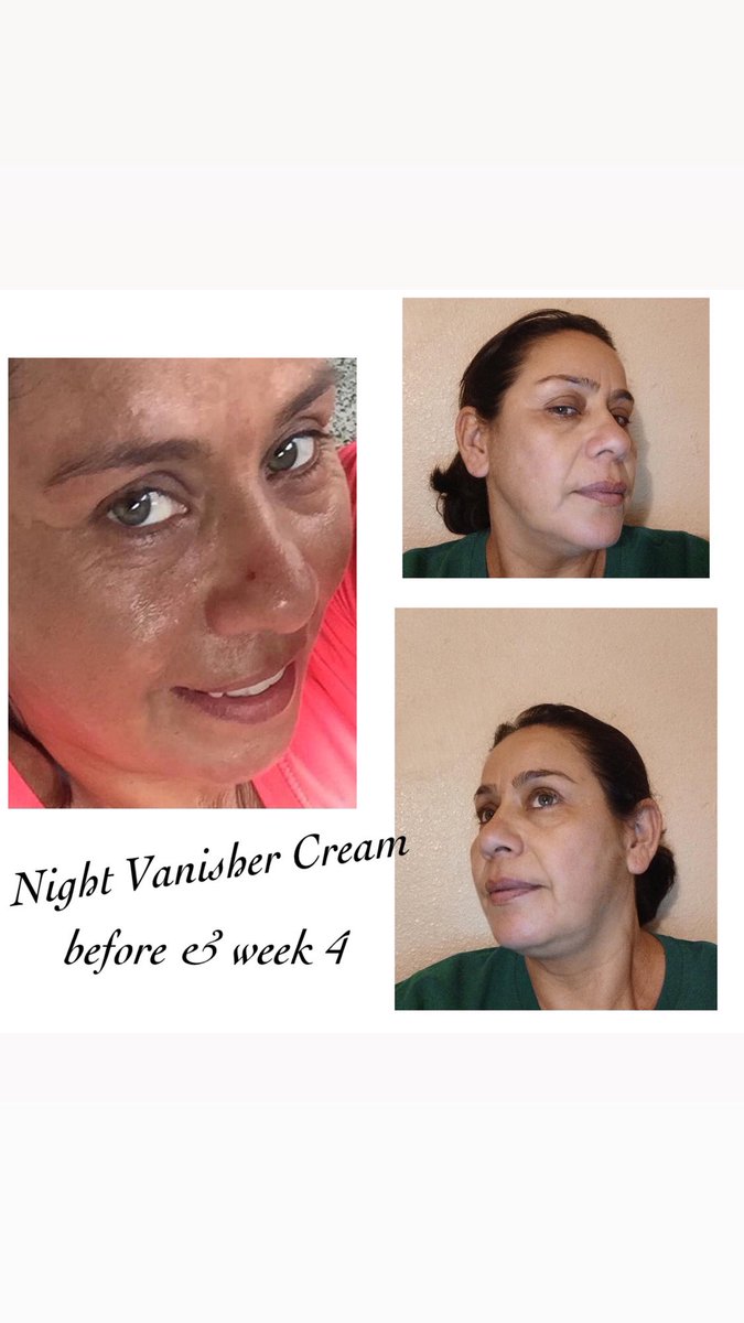 Glow Skin Enhancement tweet media