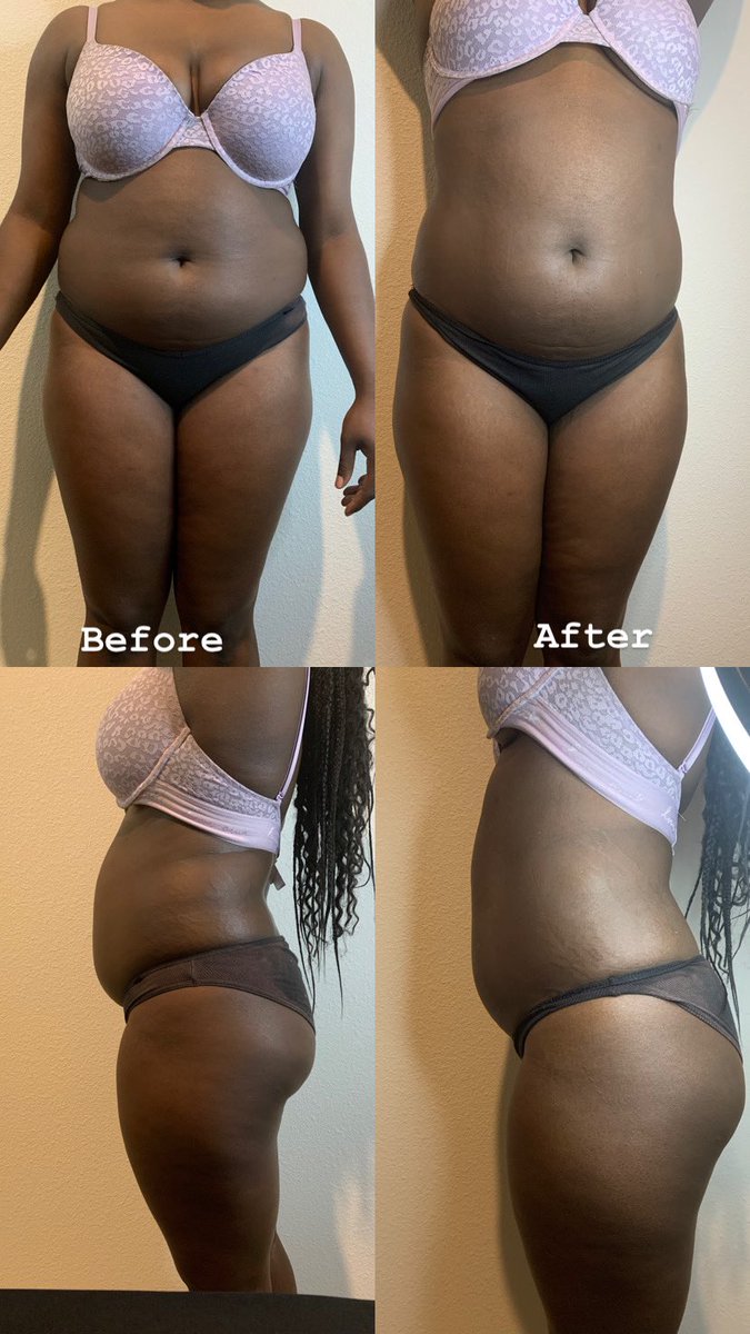 miscode4's tweet image. #bodyscultpting tap in for that #hotgirl  summer body 2022