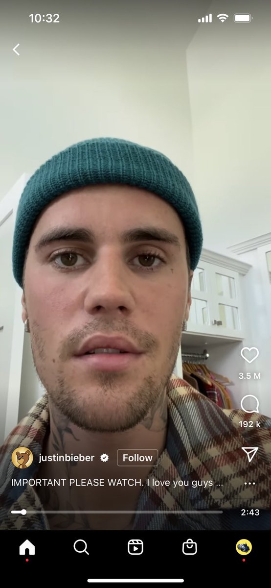 AkeemSharyzal's tweet photo. Justin bieber announce dekat ig dia, terkena virus &amp; lumpuh dekat bahagian muka. https://t.co/6jhASVZvu9