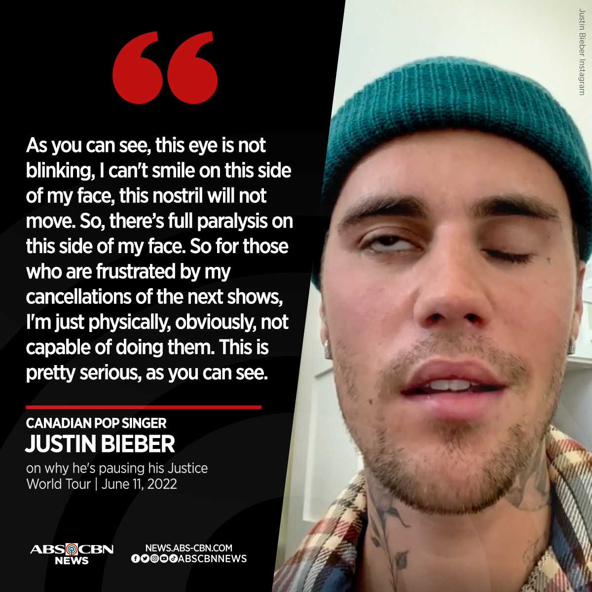 ABSCBNNews's tweet photo. Inanunsyo ni Justin Bieber na suspendido ang kaniyang Justice World Tour matapos siyang magkaroon ng Ramsay Hunt Syndrome na nagdudulot ng partial facial paralysis.

BASAHIN: https://t.co/g4t9iWrwZt https://t.co/93LTjIcQho