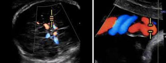ACTA ObGyn Scand tweet media