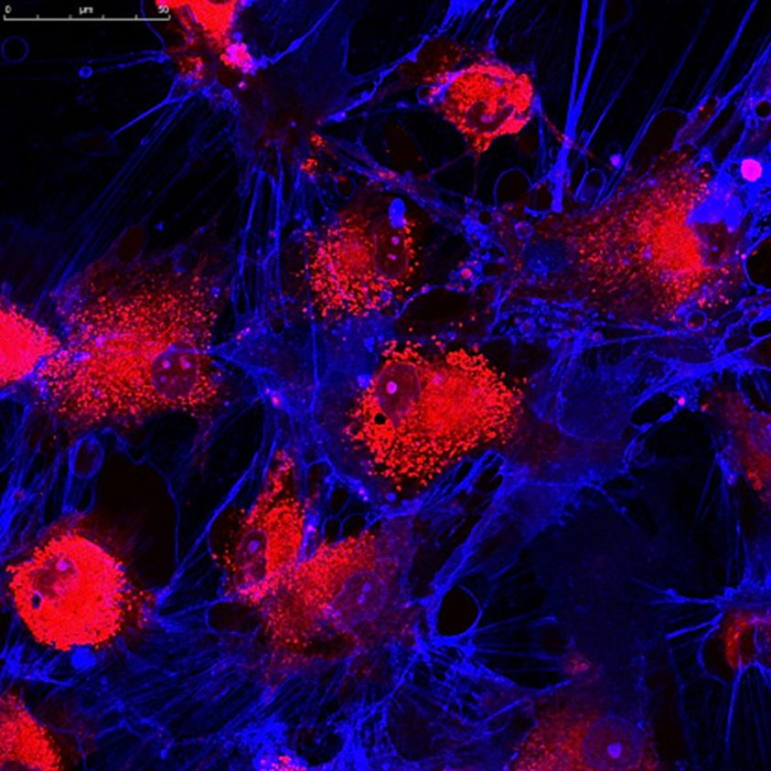 ScienceReposit's tweet photo. Therapeutic Potential of Mesenchymal Stem Cells

#Therapeutic #Mesenchymal  #StemCells #selfrenew #repair #heal #autoimmune #chemotherapy #tumorigenesis #chemotaxis  #neutrophil #chemokines #allograft 

View more at: https://t.co/2RLFUNQqwR https://t.co/sLJQRwdX5V