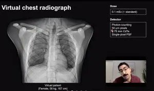 DukeCVIT's tweet photo. Did you miss any of our past #VirtualImaging forums? You can still view the video recordings on our website: https://t.co/do4ZIEfgEC @DukeRadiology @DukeEngineering @DukeMedPhys @DukeMedSchool @aapmHQ https://t.co/8Ls1KTkLHn