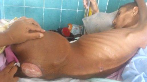 Feliz y bendecido inicio  de semana❤ 

Amig@s el día hoy necesitamos nuevamente de su apoyo, Isaac requiere con carácter  de urg Moxifloxacino de 400mg/250ml (cost 262.00;bs), para escáras se req: Sulfadiazina de plata, Espro Nipider, compresas entre otros insumos.

<a href="/MamaLisVzla/">Lisbeth Añez/Mamá Lis</a>