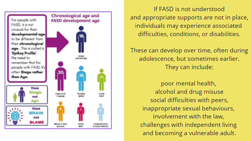 Hunter83Carol's tweet photo. Great session with our @fifecollege HNC Childcare Students today, raising the awareness of FASD and the impacts of consuming alcohol whilst pregnant.
As an adult with FASD raising awareness and getting the right support for children and young people is crucial!
#FASDmakesmeme https://t.co/Pu53mgjRrG