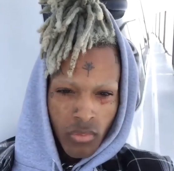 depp_marilyn's tweet photo. Who looked worse without eyebrows? Kanye or XXXTentacion? https://t.co/mJDZPaxBWy