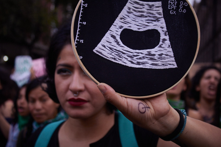 | <a href="/FerDzLn/">Fernanda Díazdeleón</a> explicó que #Guerrero tiene una diferencia importante respecto a otros estados donde se ha aprobado la #ILE. Esta diferencia consiste, en que la definición de aborto quedó establecida como “aborto es la interrupción del embarazo”.
🗞 📲 bit.ly/38Rs3zm