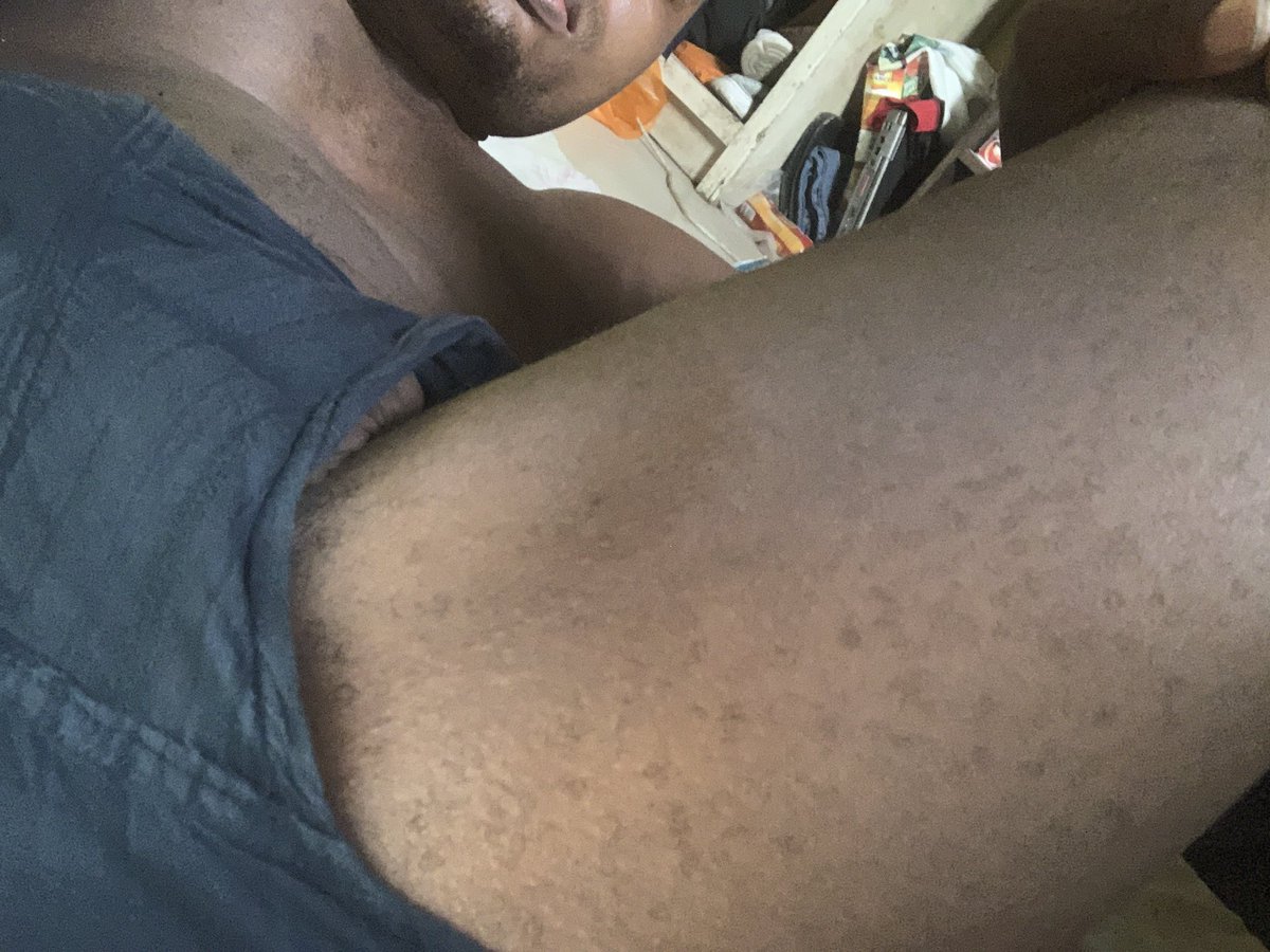 dee_jaylong's tweet photo. Hectic day today. Had some chub rubs beneath my thighs. It burns.
.
.
.
#realnasty #hotmen #hotmensbody #nudemen #mennude #menthighs #blackhotmen #blackmen #hotgaybaby https://t.co/ZbzrMQ0pcS