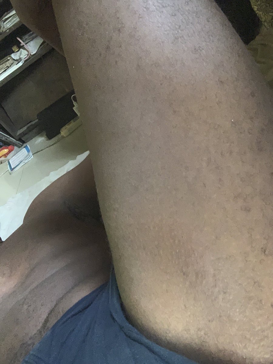 dee_jaylong's tweet photo. Hectic day today. Had some chub rubs beneath my thighs. It burns.
.
.
.
#realnasty #hotmen #hotmensbody #nudemen #mennude #menthighs #blackhotmen #blackmen #hotgaybaby https://t.co/ZbzrMQ0pcS
