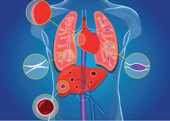 hug_ge's tweet photo. The Meeting of Experts entitled « Taking CPSS to the next level » will be held at the Faculty of Medicine of the @UNIGEnews, Auditorium Alex-F. Müller (A250), next July 1-2, 2022 (online &amp; onsite congress) #portosystemic #health #medicine https://t.co/wrCEYignht https://t.co/QfJHOpUtAt