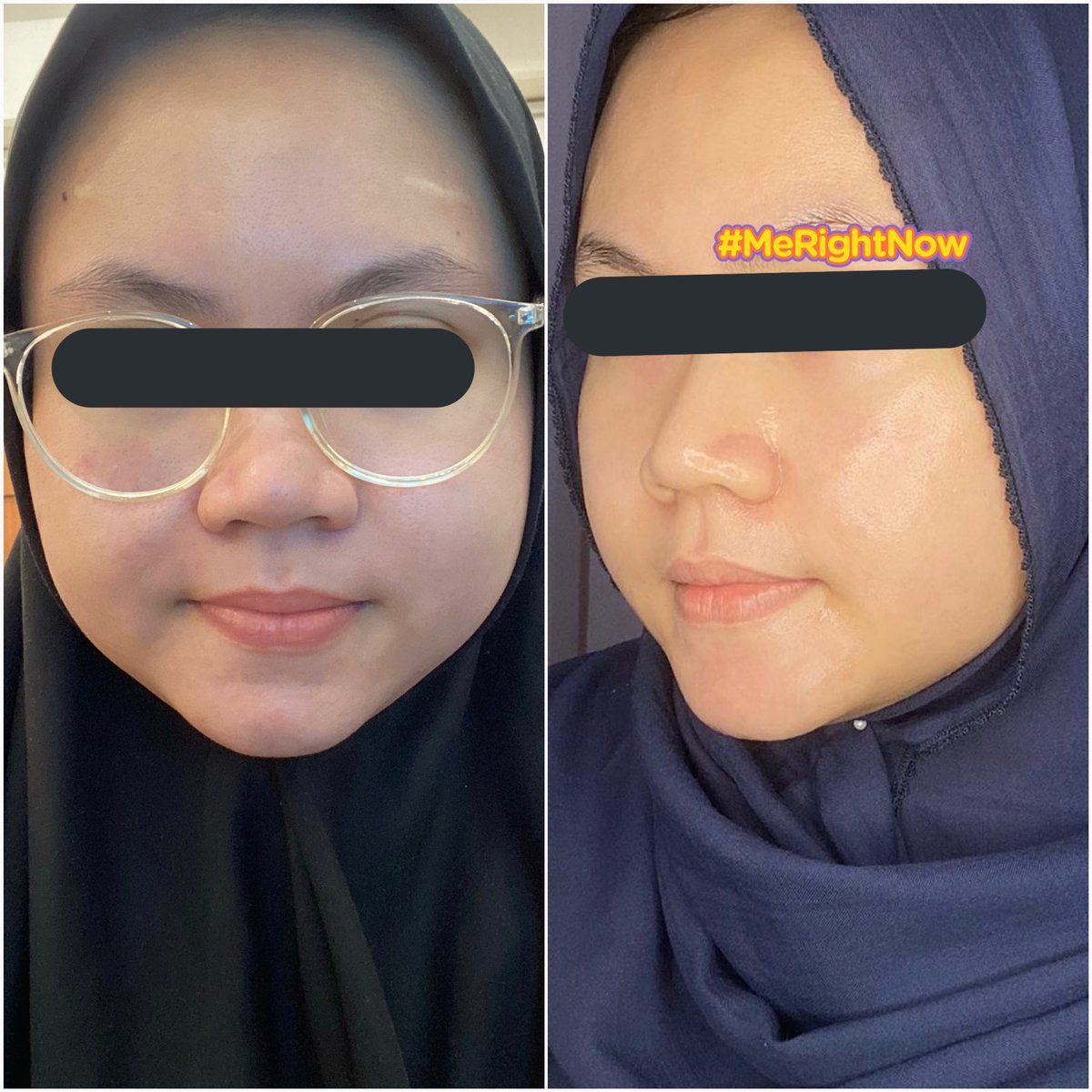 cndlrnt's tweet photo. belakangan udah ga pake banyak step skincare lagi karena sibuk banget, tapi alhamdulillah kulit tetap sehat anti kusam-kusam cuma ditreat sama 1 serum ini

bener” tertolong bgt kulitku walau cuma basic skincare + 1 serum aja, kulit tetap cerah dan jarang redness lagi😭❤️ https://t.co/ZD7XDdoLEl