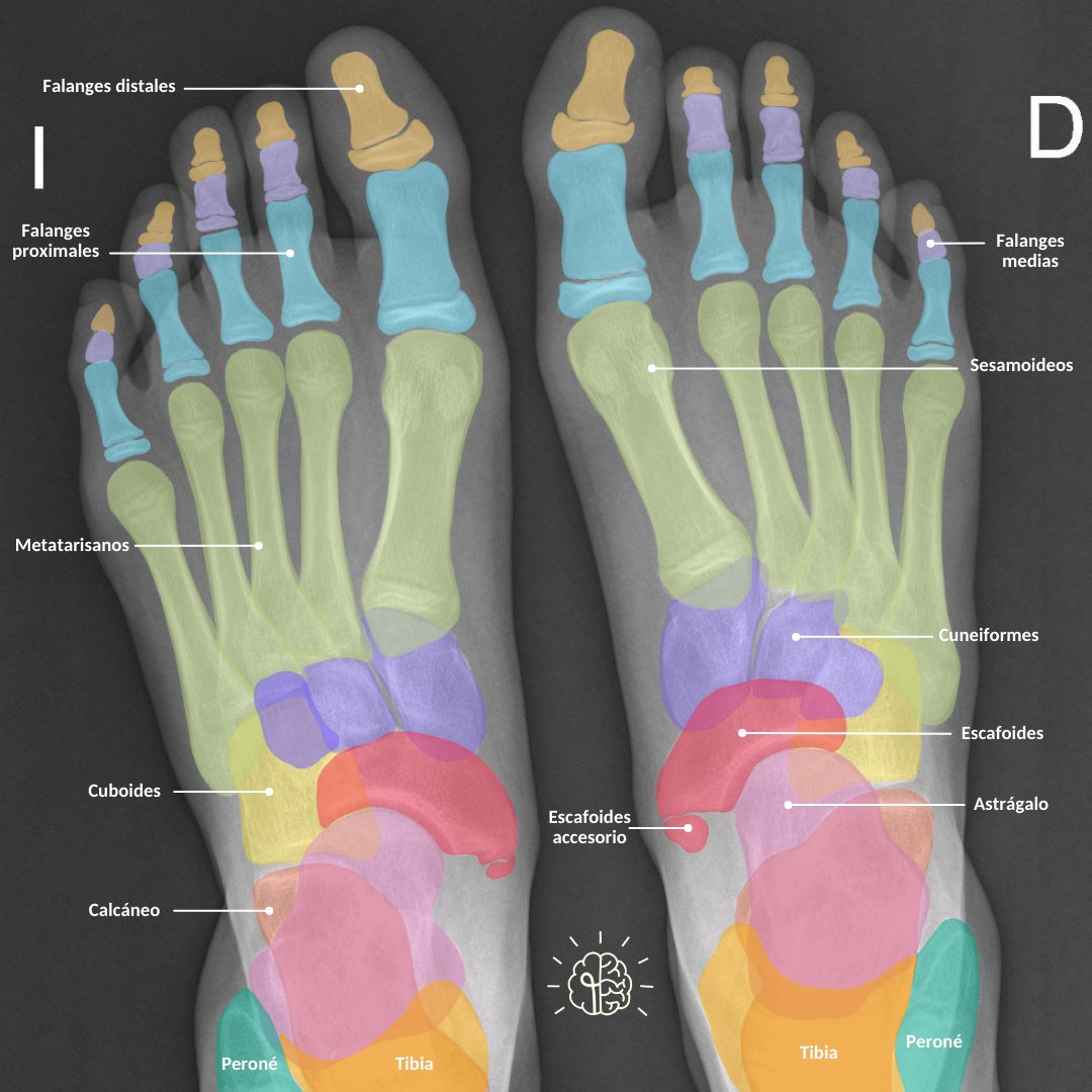 _Dubium's tweet photo. Radiografía AP de pie. #radiologia #radiology #Medical #physiotherapy #Fisioterapia https://t.co/sWoZ9y2cO5