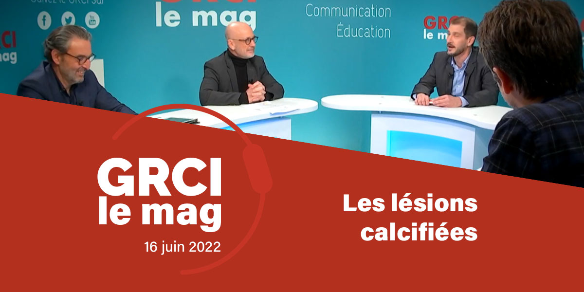 GRCI (@grcicardio) on Twitter photo 💻 Nouvelle émission #GRCI le Mag le 16 juin ! Dédiée à la prise en charge des lésions calcifiées.
@HakimBenamer, <a href="/CBrasselet51/">Camille Brasselet</a> et <a href="/JacquesMonsegu/">MONSEGU Jacques</a> discuteront avec <a href="/deharo_pierre/">pierredeharo</a> et <a href="/nicolasamabile/">Nicolas Amabile</a>.
✅ Accès libre : grci.fr/actualites/les… 💻 Nouvelle émission #GRCI le Mag le 16 juin ! Dédiée à la prise en charge des lésions calcifiées.
@HakimBenamer, <a href="/CBrasselet51/">Camille Brasselet</a> et <a href="/JacquesMonsegu/">MONSEGU Jacques</a> discuteront avec <a href="/deharo_pierre/">pierredeharo</a> et <a href="/nicolasamabile/">Nicolas Amabile</a>.
✅ Accès libre : grci.fr/actualites/les…