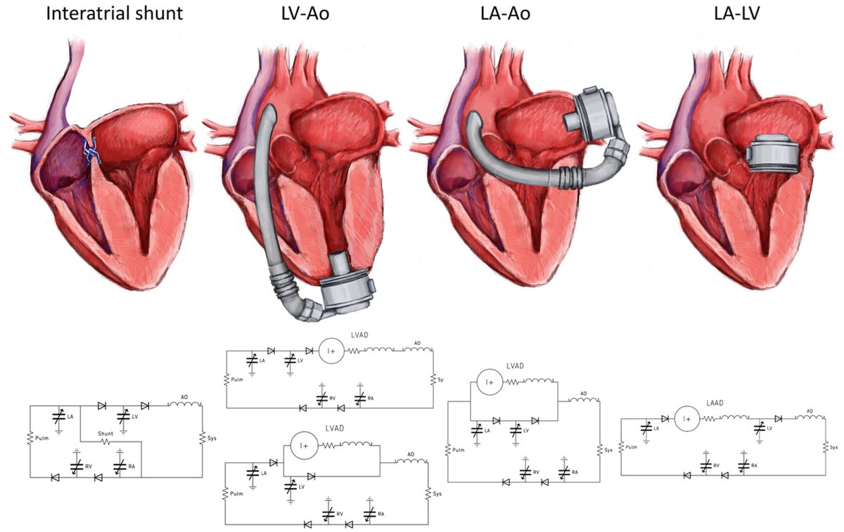 chelseywood's tweet photo. Another illustration published in @ArtifOrgans:
Mechanical and interventional support for heart failure with preserved ejection fraction: A review,
https://t.co/ZTs7cmzymu
#interatrialshunt #VAD #LAAD #LVAD https://t.co/x8KFt7QL3O