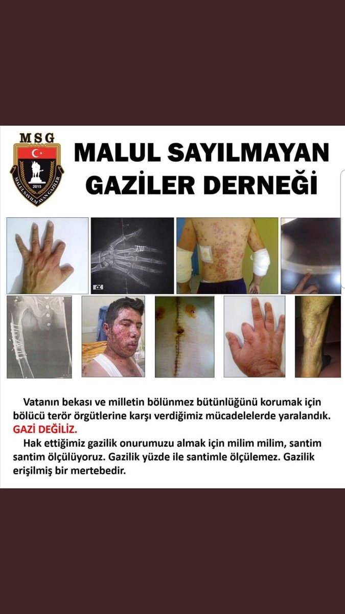 Verilen sözlerin yerine gelmesini istiyoruz kanun teklifi verildi meslisden cikmadi secimden önce 20 bin terörle mucadelede yaralanmiş arkadaşlarimizin haklari 19 eylül gaziler günunde yüzlerimiz gülmüş olmasini istiyoruz söz verildi milliyetci harekat partisi