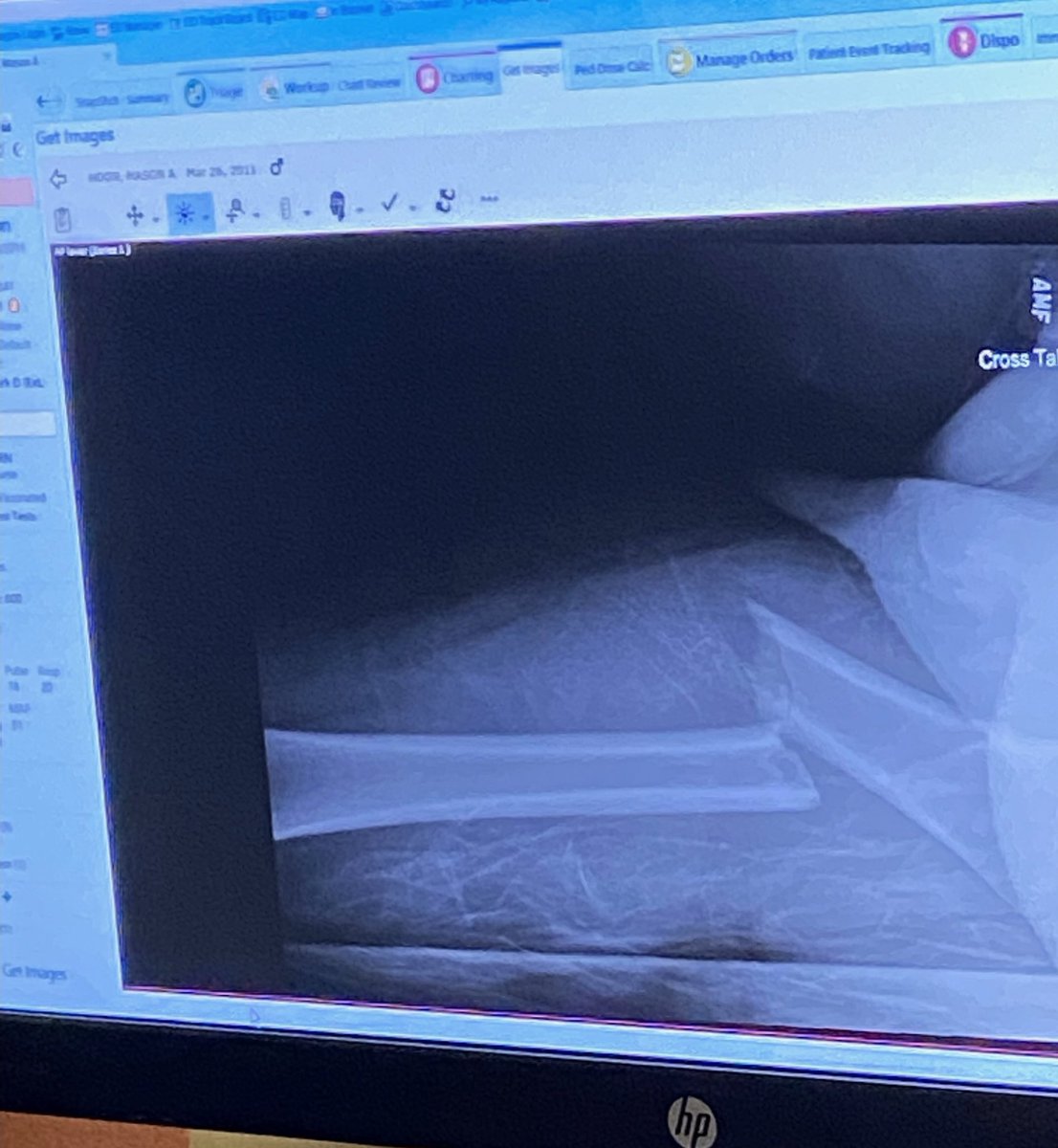 Allan Hoon tweet media