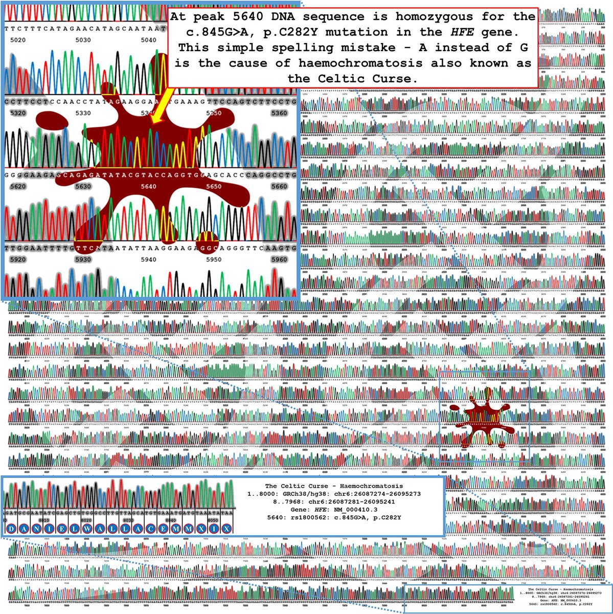 QUT's tweet photo. #QUT genetic researcher Dr Dan Wallace transformed his #DNA sequence chromatograms into artworks to raise funds and awareness of haemochromatosis - an underdiagnosed and life-threatening iron overload disorder. #WHW2022 @QUT_Genomics @dansdnadesigns https://t.co/14nTjk9RiX https://t.co/lcp4AUd9Yx