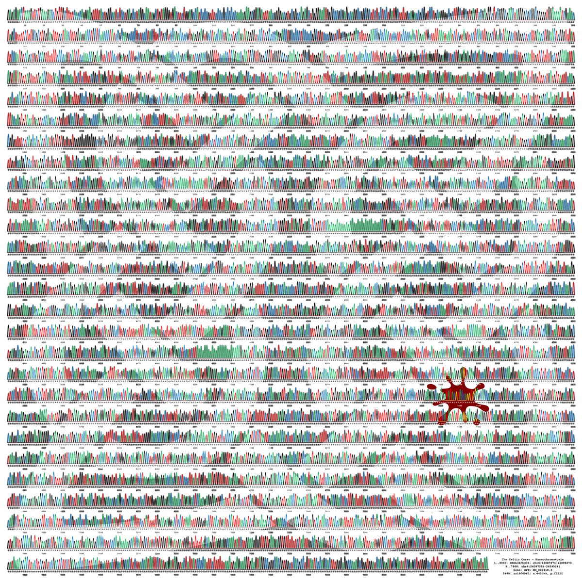 QUT's tweet photo. #QUT genetic researcher Dr Dan Wallace transformed his #DNA sequence chromatograms into artworks to raise funds and awareness of haemochromatosis - an underdiagnosed and life-threatening iron overload disorder. #WHW2022 @QUT_Genomics @dansdnadesigns https://t.co/14nTjk9RiX https://t.co/lcp4AUd9Yx
