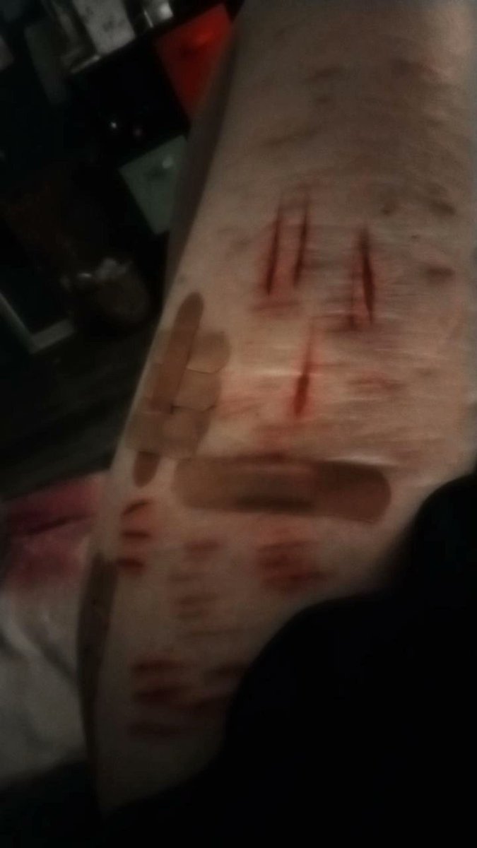idk_how2cope's tweet photo. TW s3lfh4rm
.
.
.
.
.
.
shtwt armgillstwt styrotwt catscratchtwt goretwt babybeanstwt https://t.co/BRPNTByn7L