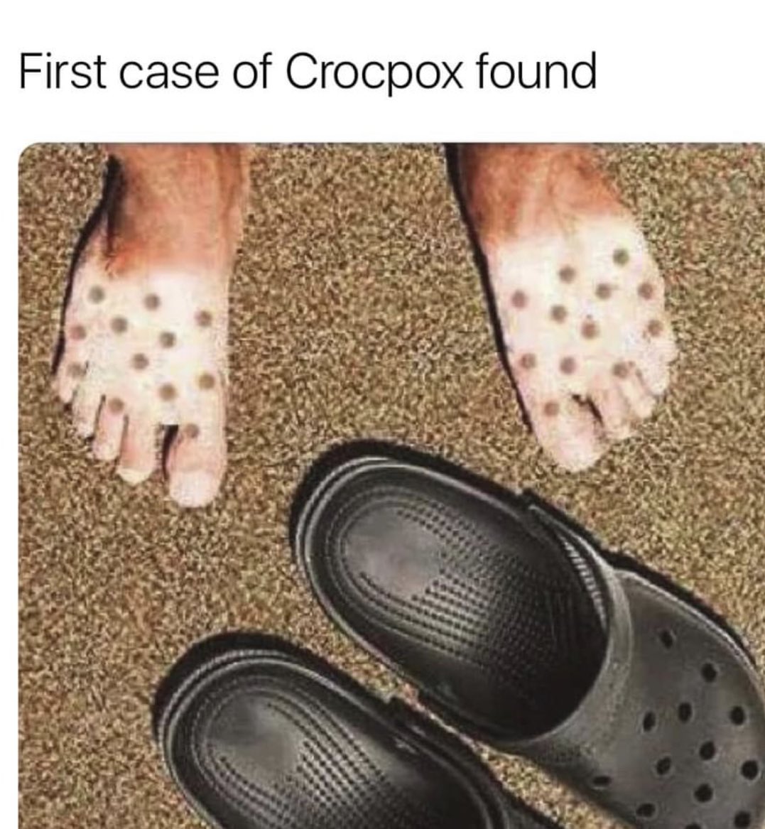 Total 104+ imagen crocs sunburn feet Abzlocal.mx