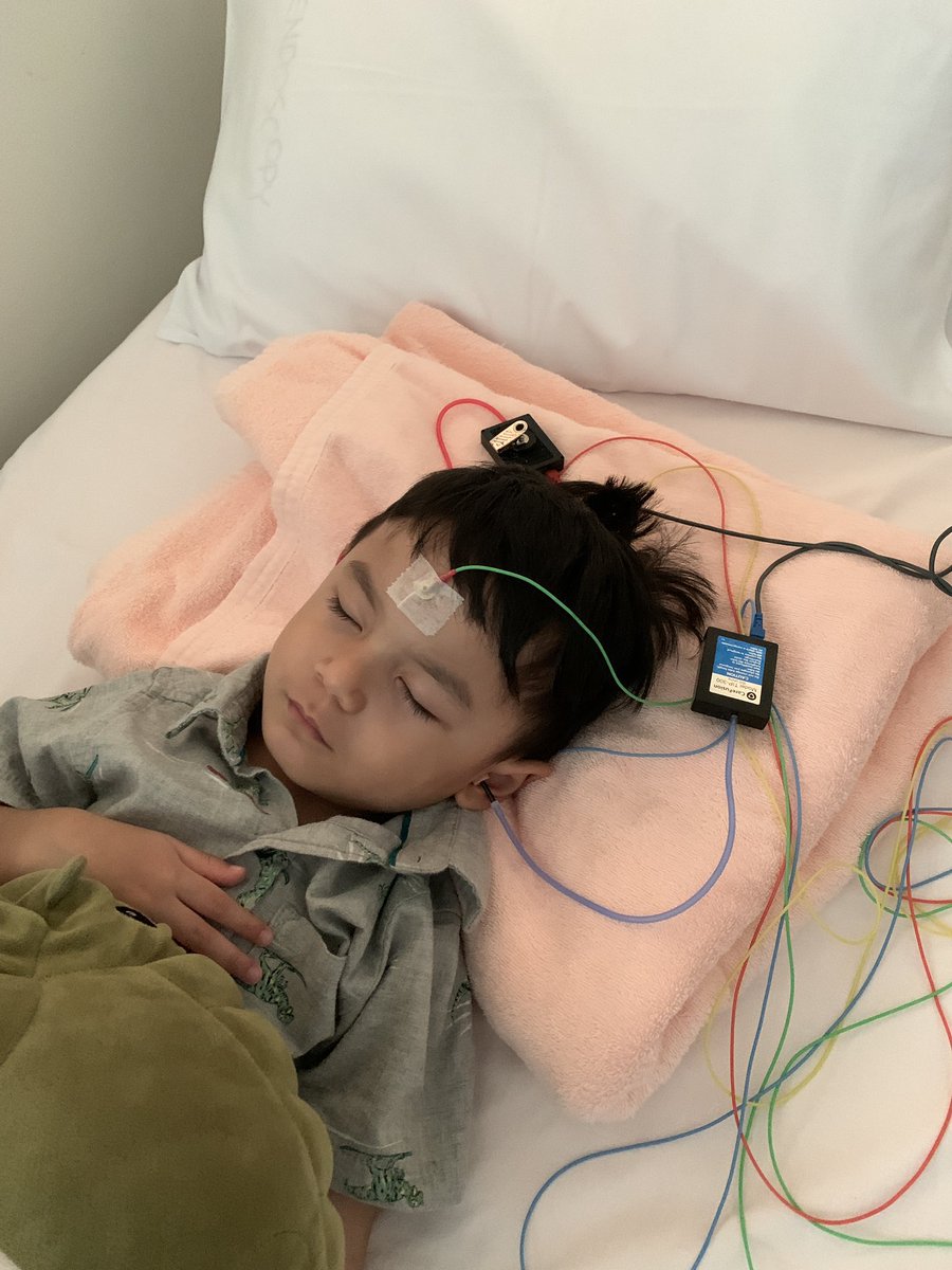 skinnyondinie's tweet photo. Croco, thank you teman Dillan tidur. ❤️

We have already got our #mildautism #asd diagnosis from Dr. Sofiah few weeks ago, but we still want to get this BAEP test done for Dillan.

(currently drafting more tweets for sharing, tunggu ya)

https://t.co/pkK8h3hW8k https://t.co/gEqLdCVuFL