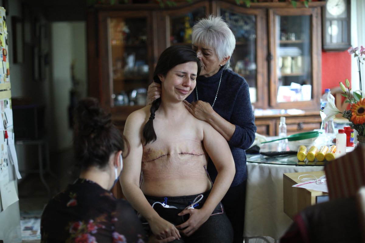 el_pais's tweet photo. [1/11] @sandra_monroy abrió las puertas de su casa a la fotógrafa @SashenkaMiss tras someterse a una mastectomía bilateral que le salvó la vida. Y surgió esta foto, ganadora de los #PremiosOrtegayGasset a mejor fotografía. 

Esta es la historia detrás de la poderosa imagen 🧵 https://t.co/uYLb1750y9