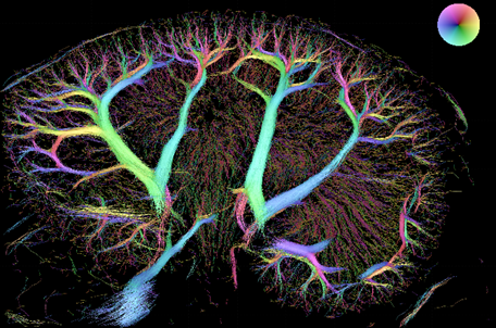 Charlotte Mehlin Sørensen (@charlottemehlin) on Twitter photo The beauty of the renal vascular tree generated by Super-Resolution UltraSound #SRUS <a href="/i_taghavi/">Iman Taghavi</a> <a href="/mostafaaminnaji/">Mostafa</a> <a href="/sofiebechander1/">sofie bech andersen</a> <a href="/DTU_Ultrasound/">Center for Fast Ultrasound Imaging</a> @BiomedUCPH #renalphysiology
Struggling to discover how this network functions🤓 The beauty of the renal vascular tree generated by Super-Resolution UltraSound #SRUS <a href="/i_taghavi/">Iman Taghavi</a> <a href="/mostafaaminnaji/">Mostafa</a> <a href="/sofiebechander1/">sofie bech andersen</a> <a href="/DTU_Ultrasound/">Center for Fast Ultrasound Imaging</a> @BiomedUCPH #renalphysiology
Struggling to discover how this network functions🤓