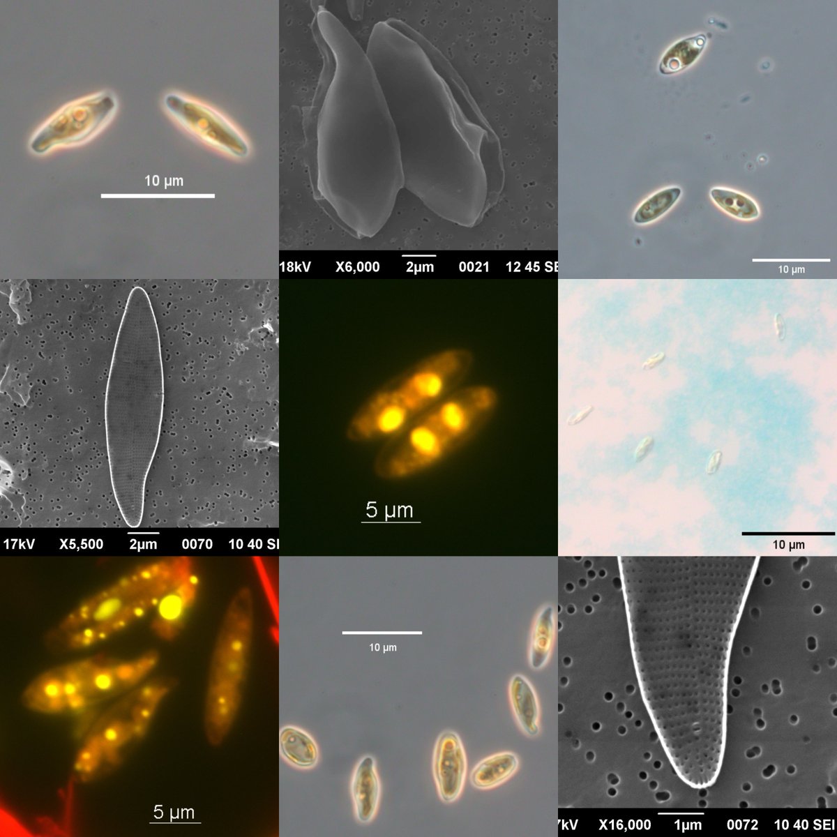 Very cool microscopic images taken by ACES+ student Leena Mary Pushpam from her current thesis work at SAMS, Scotland. Leena is exploring whether polar diatoms can be replaced as a source of lipid for #aquaculture feed and if it can be grown at scale in cold climate countries. 👏