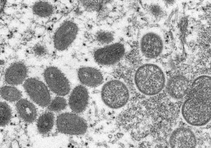 LSHTM's tweet photo. ❓ What caused this #monkeypox outbreak?
❓ Is it similar to #COVID19?
❓ Were we prepared?

Our infectious disease expert, Jimmy Whitworth, breaks down the key facts about the disease 📝

Full Q&amp;A 👉 https://t.co/ik33oMuI5z #PublicHealth https://t.co/g6YxyO1AAT