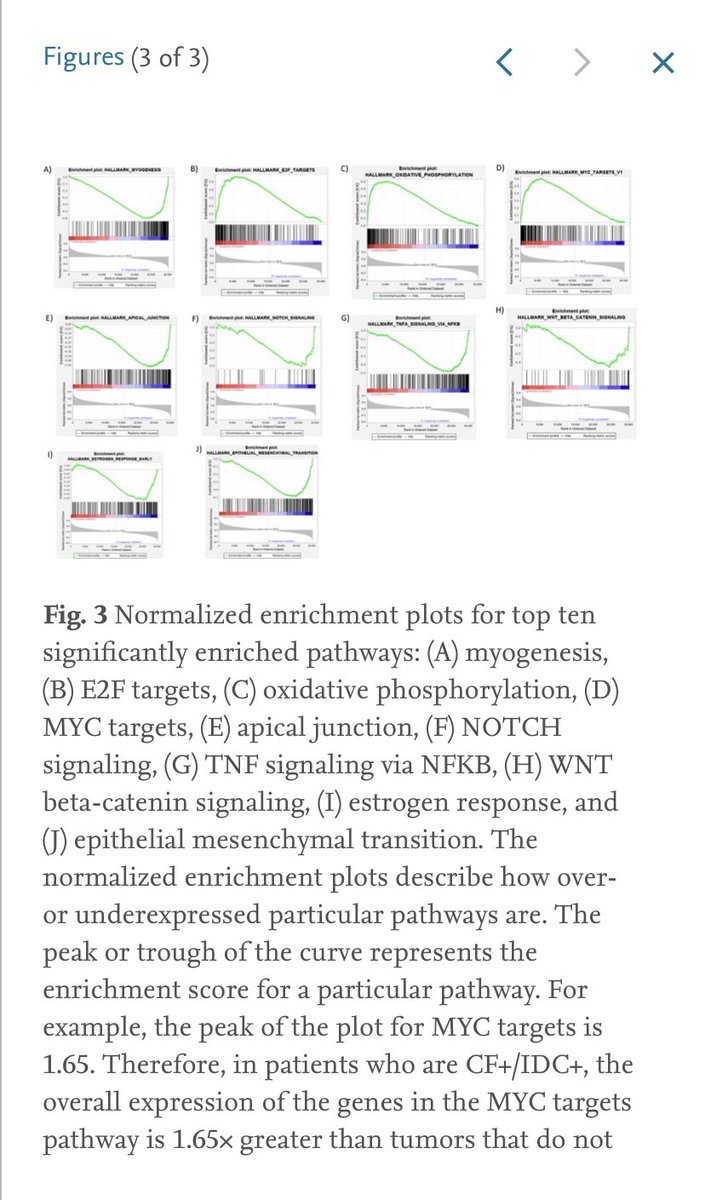 Tarik Benidir (@tarikbenidir) on Twitter photo Happy to share our <a href="/CleClinicUro/">Cleveland Clinic Urology</a> findings: high risk Decipher scores are associated with the presence of Cribriform either alone or in combination with Intraductal Carcinoma features at RP. authors.elsevier.com/a/1fA8y8Yy0LMx… Happy to share our <a href="/CleClinicUro/">Cleveland Clinic Urology</a> findings: high risk Decipher scores are associated with the presence of Cribriform either alone or in combination with Intraductal Carcinoma features at RP. authors.elsevier.com/a/1fA8y8Yy0LMx…