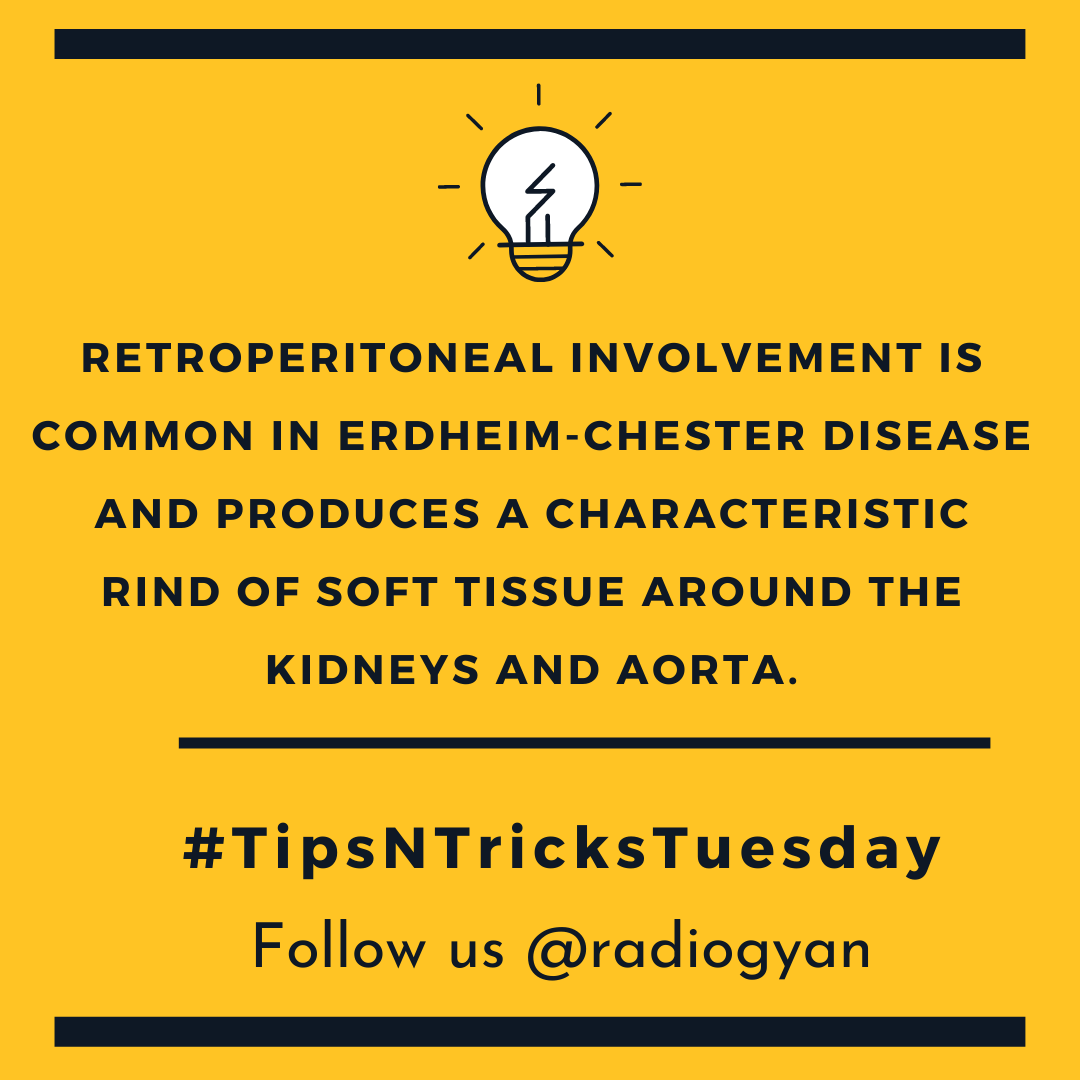 TeamRadioGyan's tweet photo. #TipsnTricksTuesday 

Here is a new pearl. 

All credits to #TeamGyan member Dr. Disha Lokhandwala.
Follow her on Instagram @dishasradiologyillustrations.

#gut #kidney #nephro #uro
#Foam #radres #radiogyan    
#radiology #education #internet https://t.co/XansHEl2Gz