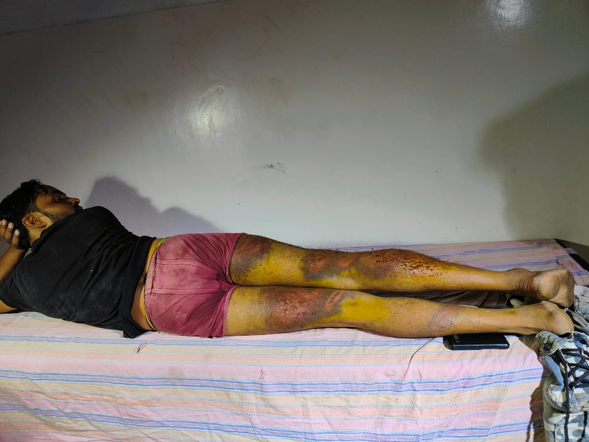 #lko बिजनौर थाने में तैनात पुलिसकर्मियों पर युवक को पीटने का आरोप,पीड़ित सुभाष रावत ने लगाया आरोप कहा नशे में धुत पुलिस कर्मियों ने थाने ले जाकर की बुरी तरह से की पिटाई <a href="/lkopolice/">LUCKNOW POLICE</a>
<a href="/Uppolice/">UP POLICE</a>  <a href="/dgpup/">DGP UP</a> <a href="/dcpcentrallko/">DCP Central Lucknow</a> <a href="/CMOfficeUP/">CM Office, GoUP</a> <a href="/News1IndiaTweet/">News1India</a> <a href="/homeupgov/">Home Department, UP</a>