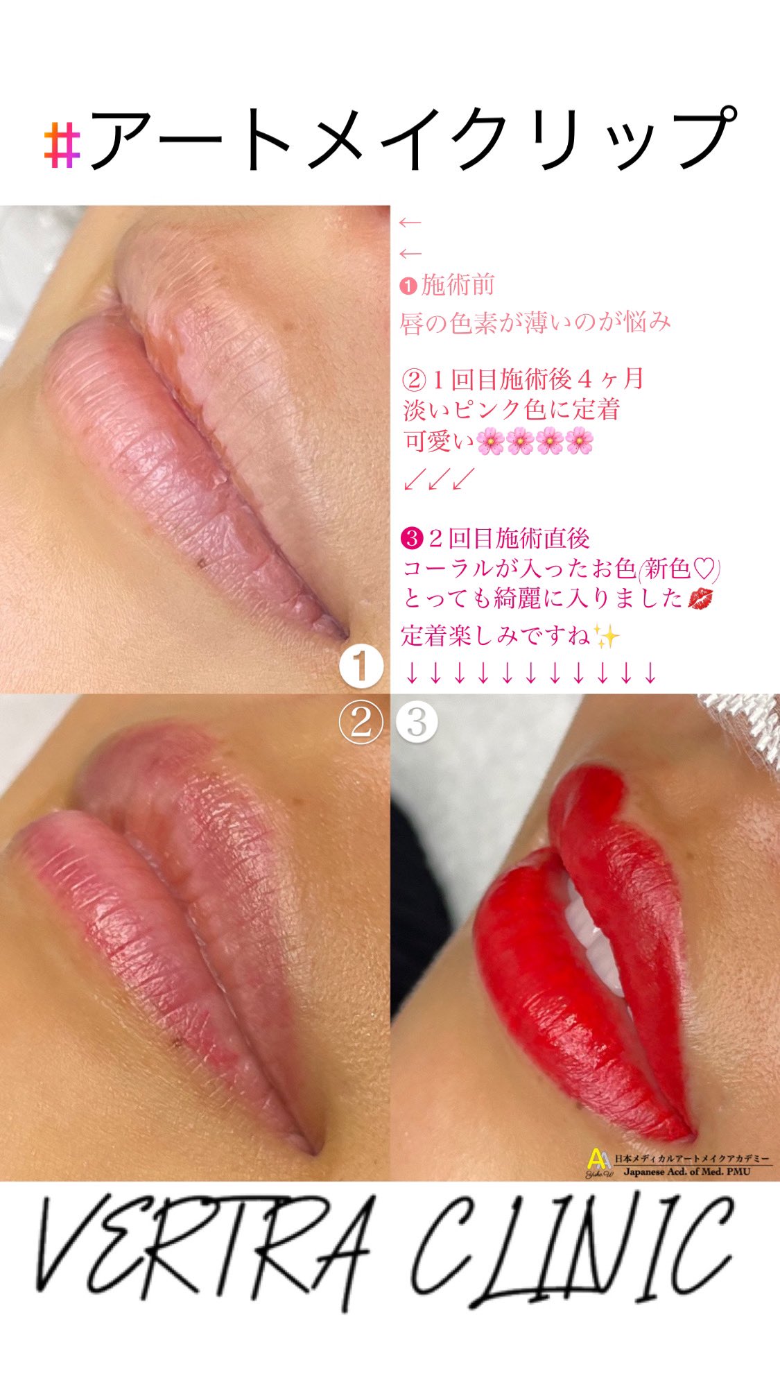 アートメイク大阪 心斎橋 堺東 都島区 梅田 アートメイク 若林 Yuxx Art Twitter