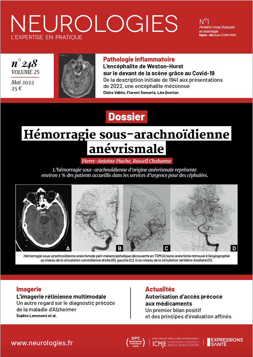 Retrouvez le dossier du mois sur l'HSA anévrismale par l'équipe de neuroréanimation clermontoise ! 

neurologies.fr/hemorragie-sou…