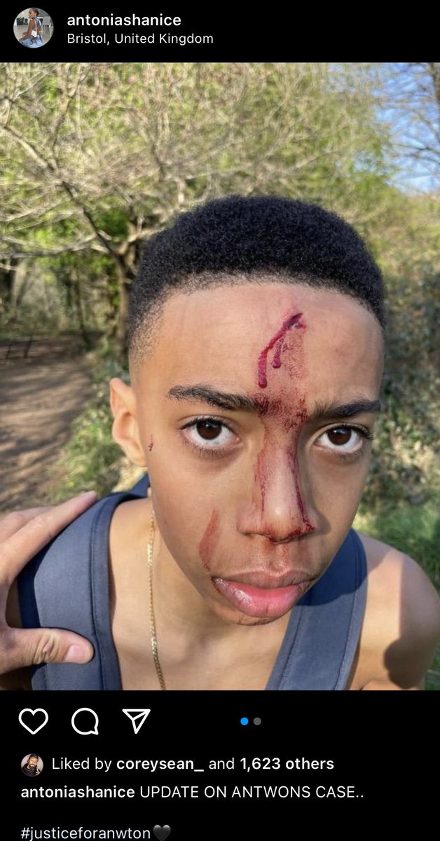 TheRealCeeee's tweet photo. #justiceforantwon “high profile incident” it’s just appalling how they’re trying to play this one out like it was all accidental! A grown ass woman attacked him &amp; a video to prove her hostility towards all the kids. Also her false statement.🤦‍♀️Please repost, more needs to be done. https://t.co/WyGuYM63c3